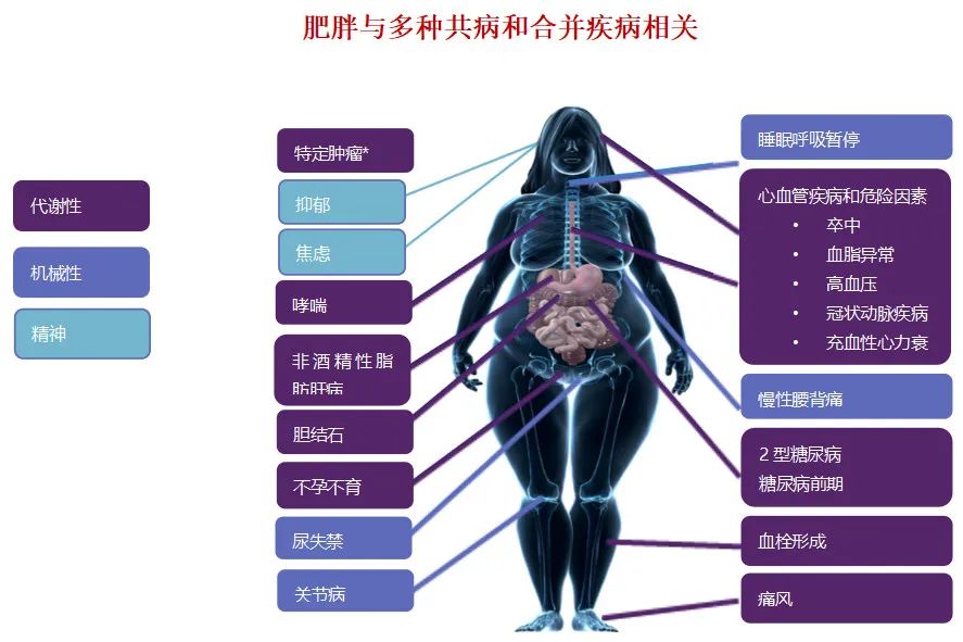 東方醫(yī)院集團總醫(yī)院成立“減重中心”——內分泌科、胃腸外科、營養(yǎng)科聯(lián)合讓您“如釋重負”