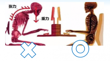 腰椎間盤突出的預(yù)防