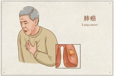 國(guó)際肺癌日，一起抵制肺癌！